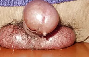 Bebrillten fand erre ...